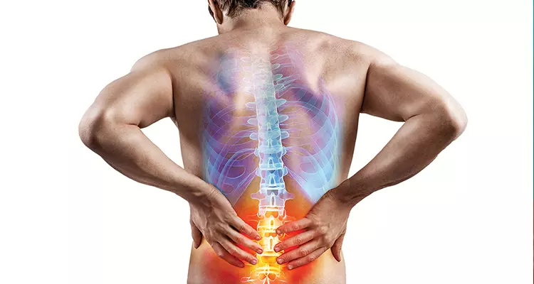 Pharmacists’ role in managing low back pain