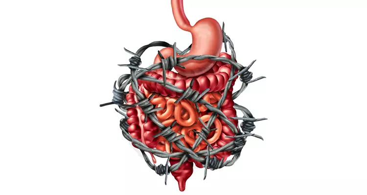 Management Strategies for Irritable Bowel Syndrome