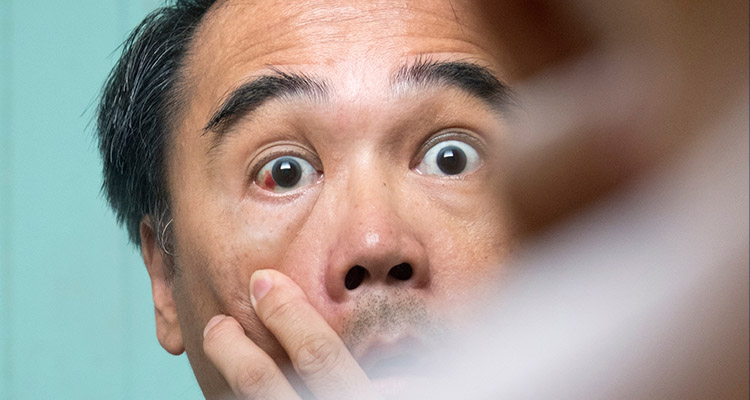 Red Eye and Eye Emergencies: Management Approach for the Primary Care Physician
