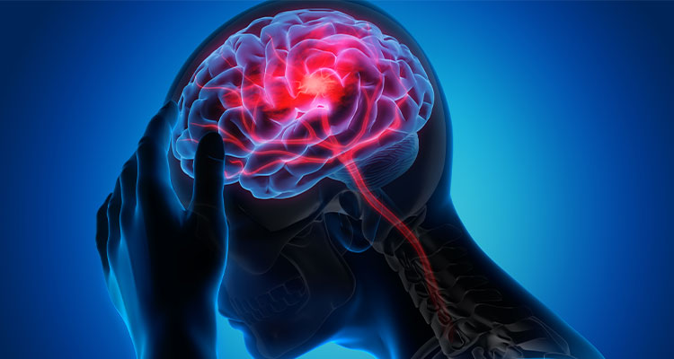 Navigating the Choice of NOACs for Stroke Prevention in AF 