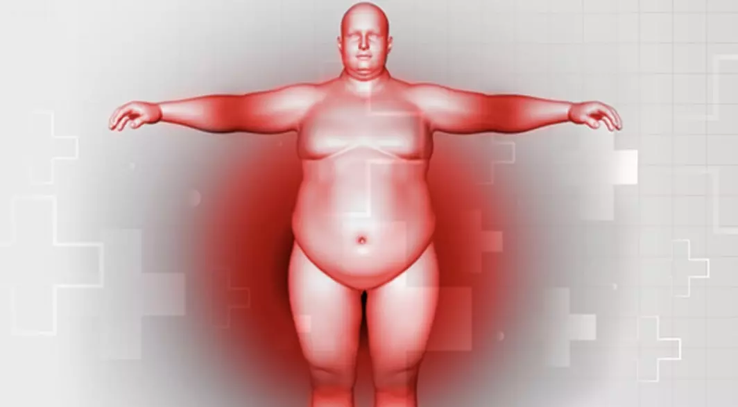 Overview of Non-surgical Management of Obesity in Adults