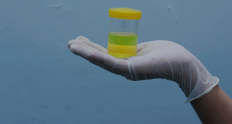 Urinary Tract Infection in Adults