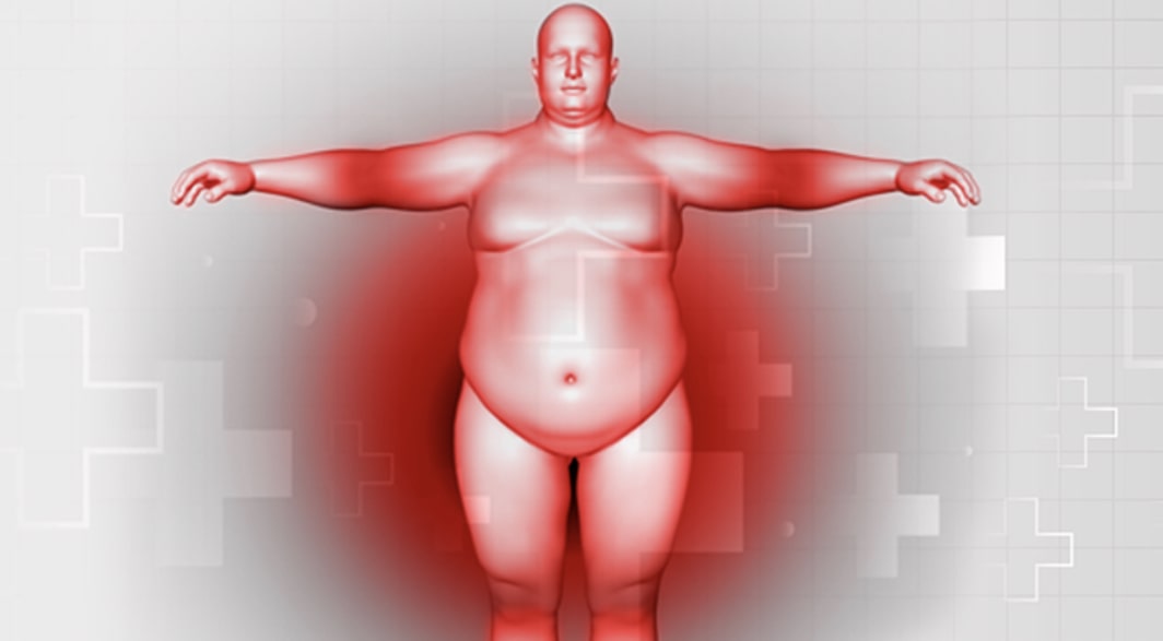 Overview of Non-surgical Management of Obesity in Adults