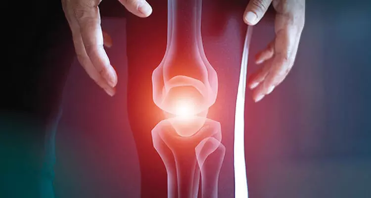 Updates in the management of knee OA: Optimising care with SYSADOAs